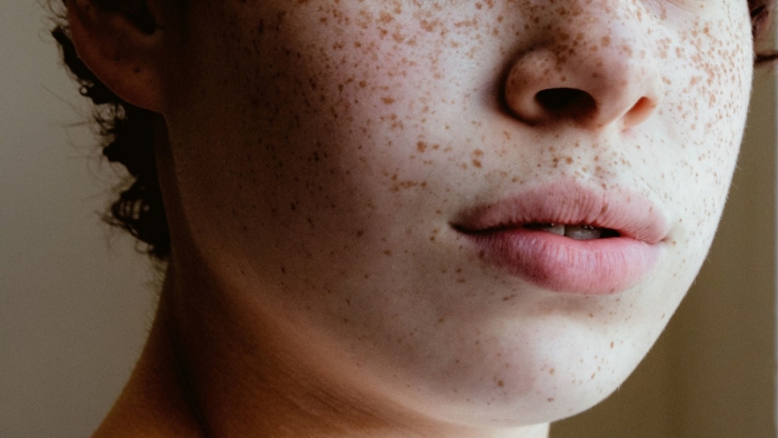 close up human face with freckles